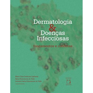 Dermatologia & Doenças Infecciosas: Fundamentos e Condutas