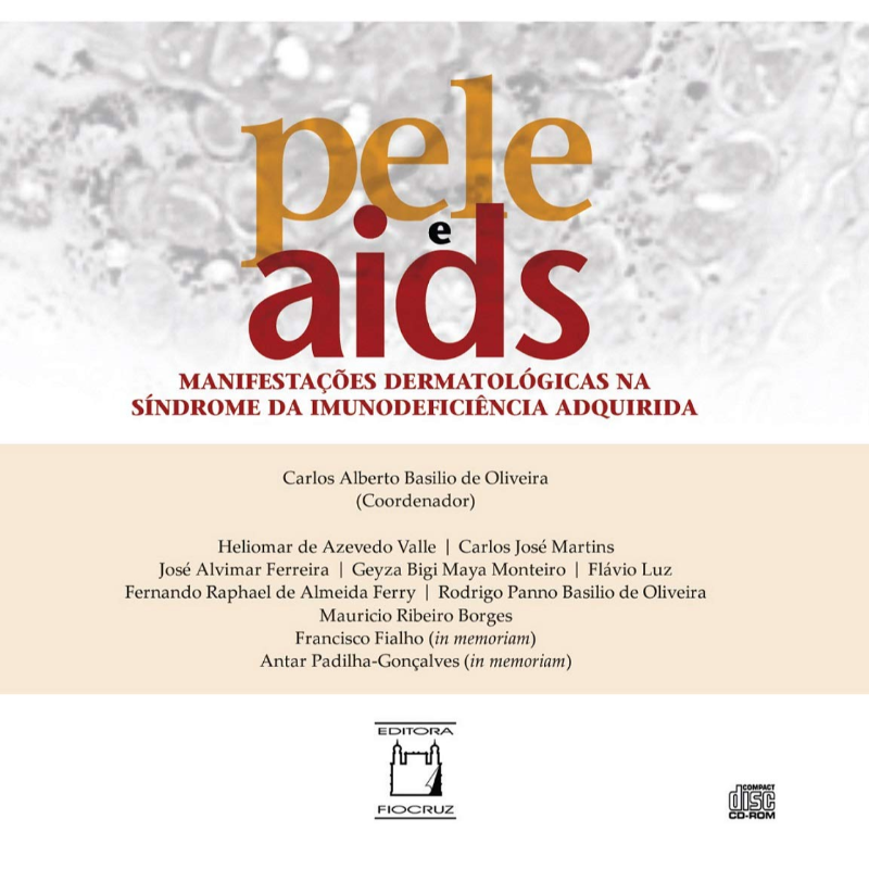 Pele e Aids: Manifestações Dermatológicas na Síndrome da Imunodeficiência Adquirida (CD)