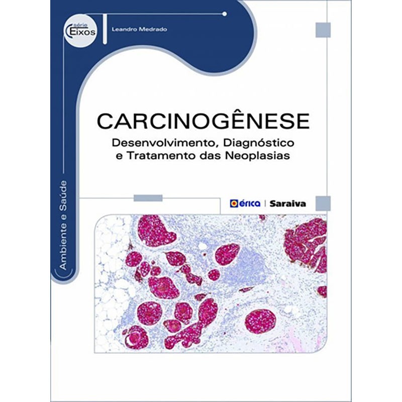 Carcinogênese: Desenvolvimento Diagnóstico e Tratamento Das Neoplasias - Série Eixos